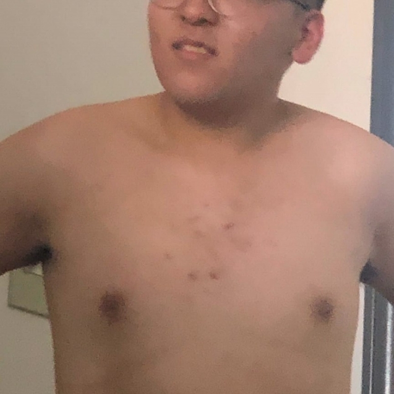煎蛋男孩