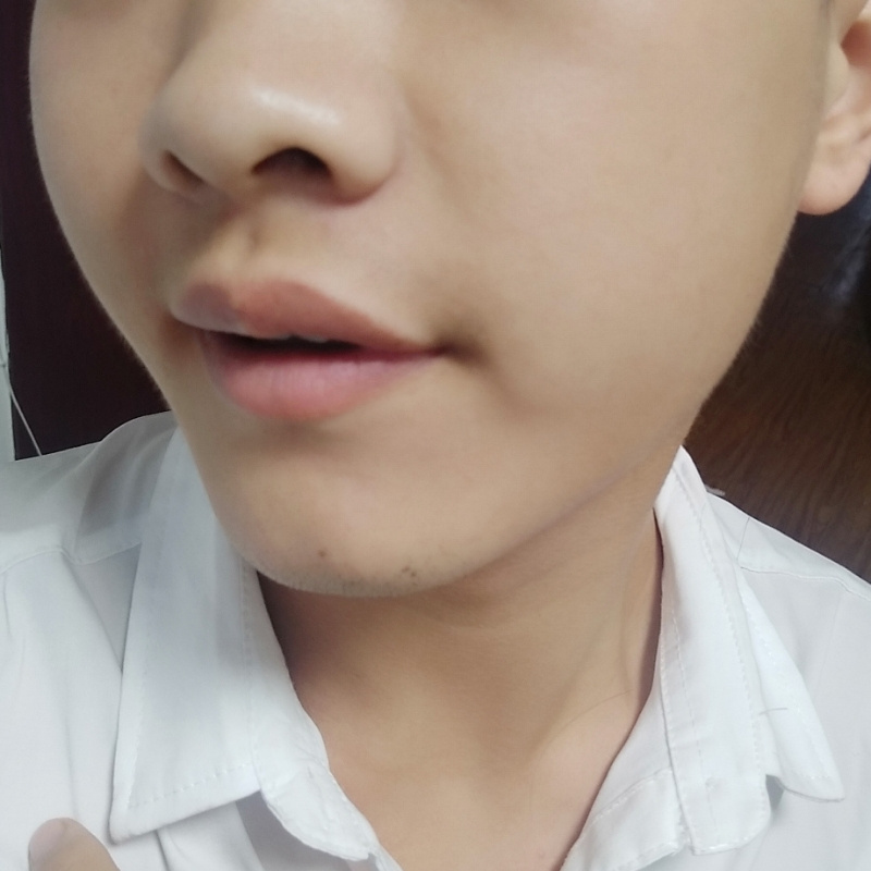北诺成尘