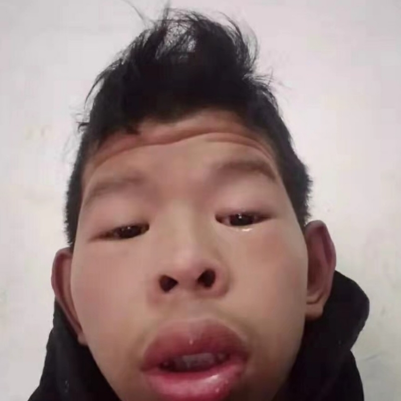 追猎