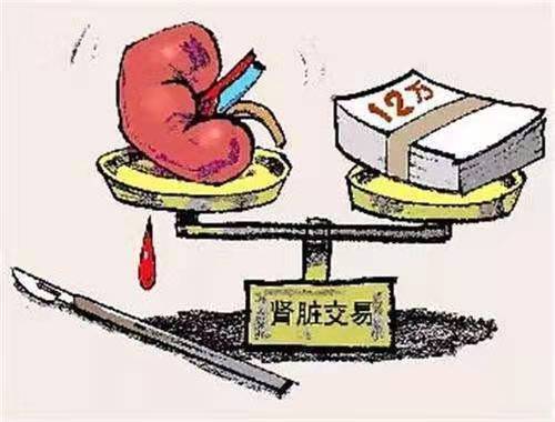 人体器官可以买卖吗？