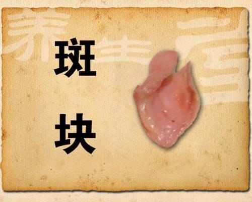 硬化&斑块课程
